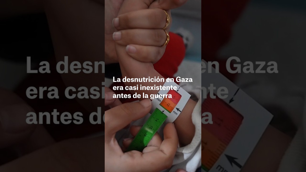 Desnutrición en Gaza, inexistente antes de la guerra