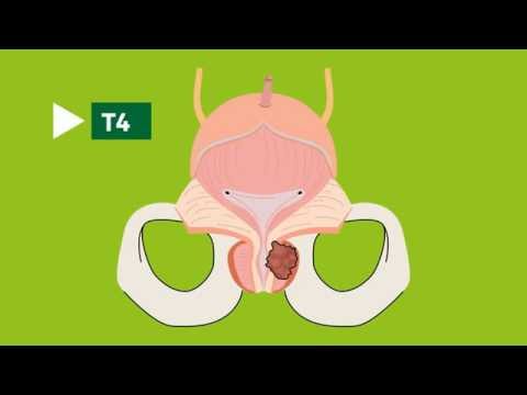 prostatická masáž pornočerná afrika sex obrázky