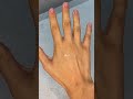 Knuckle Hair Removal