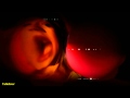Yello Vicious Games Feat Hardfloor HQ Sound