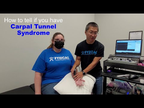 Carpal Tunnel Syndrome Diagnosis NCS/EMG