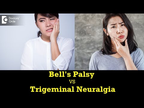 Difference between Bell's Palsy and Trigeminal Neuralgia 