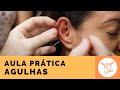 Auriculoterapia aula prática: Aplicação de agulhas  - Dumas Belasco