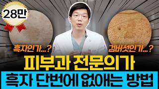 피부과 전문의가 흑자 한 번에 없애는 방법 알려드릴게요