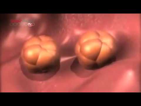 Comment se forment les jumeaux ? (La grossesse gémellaire)