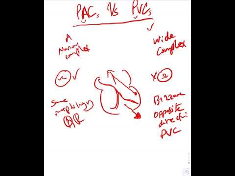 PAC vs PVC - Dr Jamal USMLE