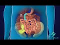 SASI Bypass Or SASI Bipartition Animation By Obesity Health S C