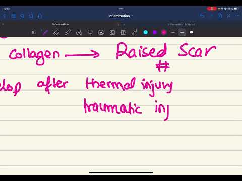 2.17 Complications of Wound Healing || Inflammation & Repair ||