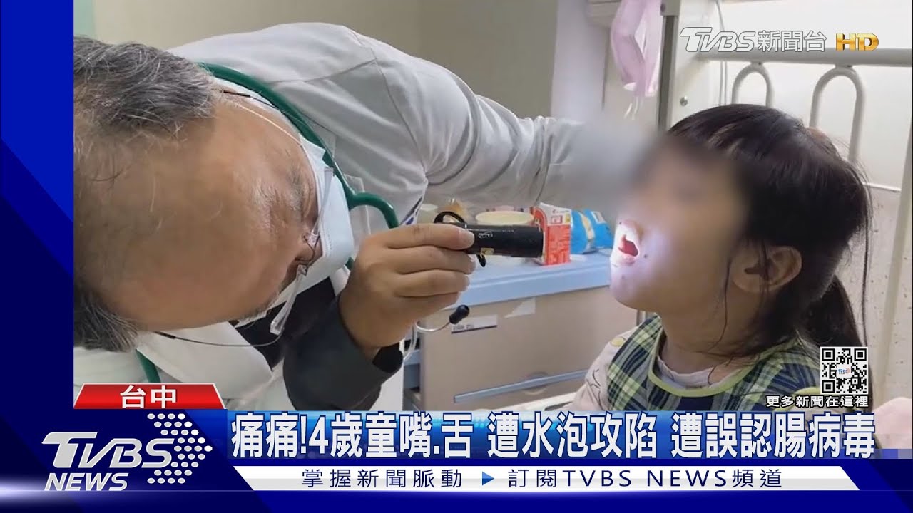痛痛!4歲童嘴、舌遭水泡攻陷 遭誤認腸病毒