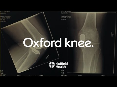 Oxford Partial Knee Replacement