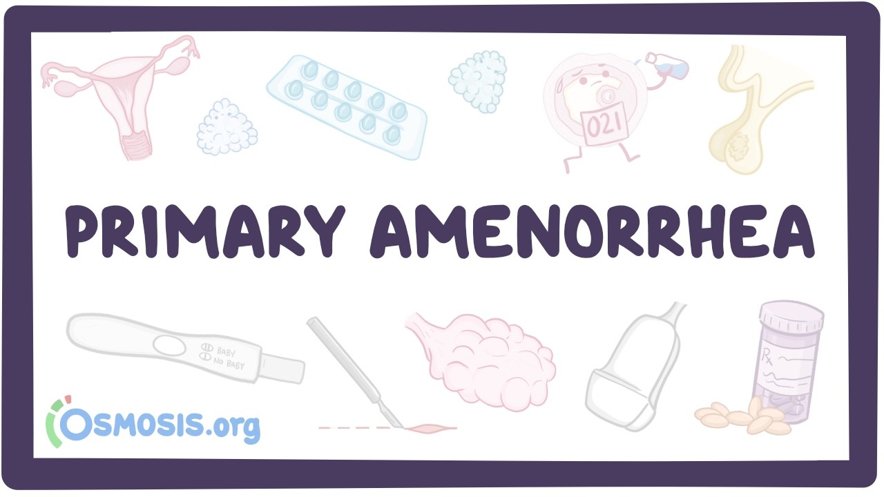 Primary amenorrhea - physiology, pathology, diagnosis, treatment