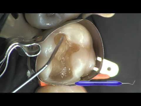 LM Arte - Applica Twist