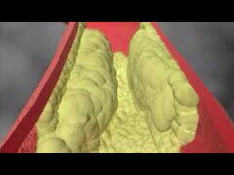 Sinjalet e fshehura që tregojnë se i keni enët e gjakut të bllokuara