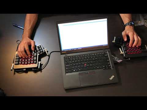 Preventing Back and Neck Strain Hopefully.....ErgoDox EZ Unboxing