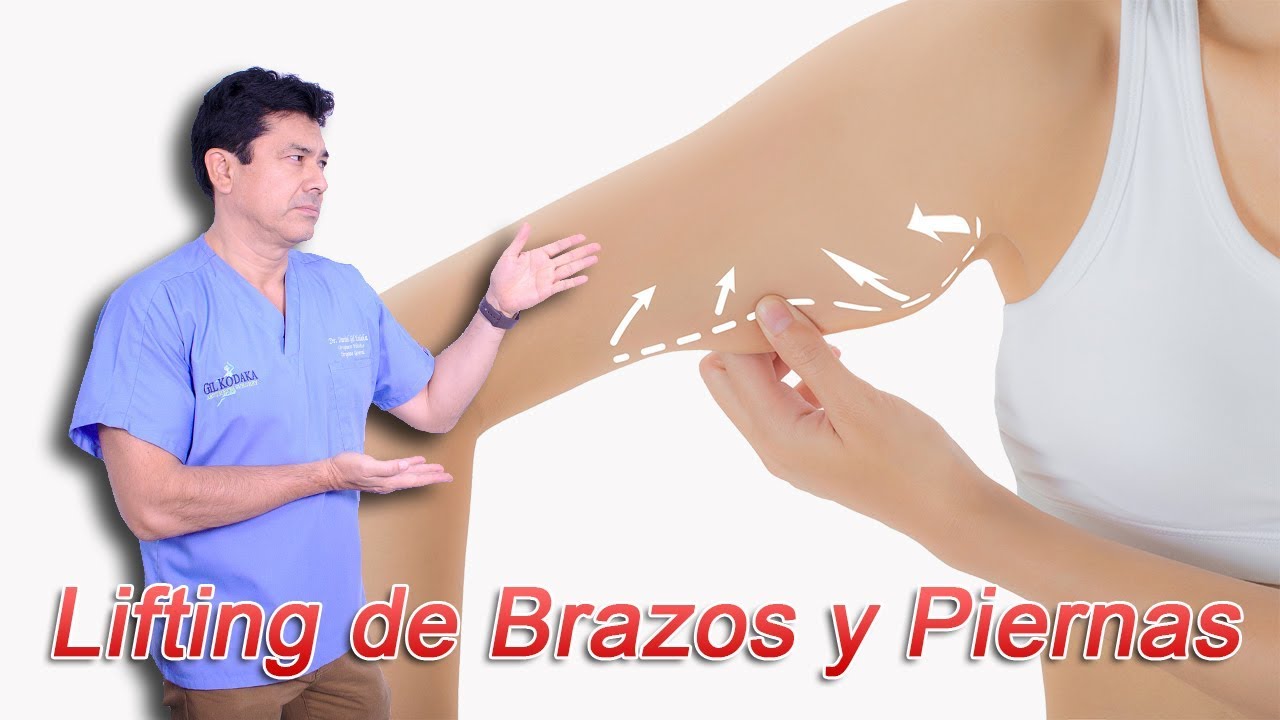 ¿Qué es el Lifting de Brazos y el Lifting de Piernas