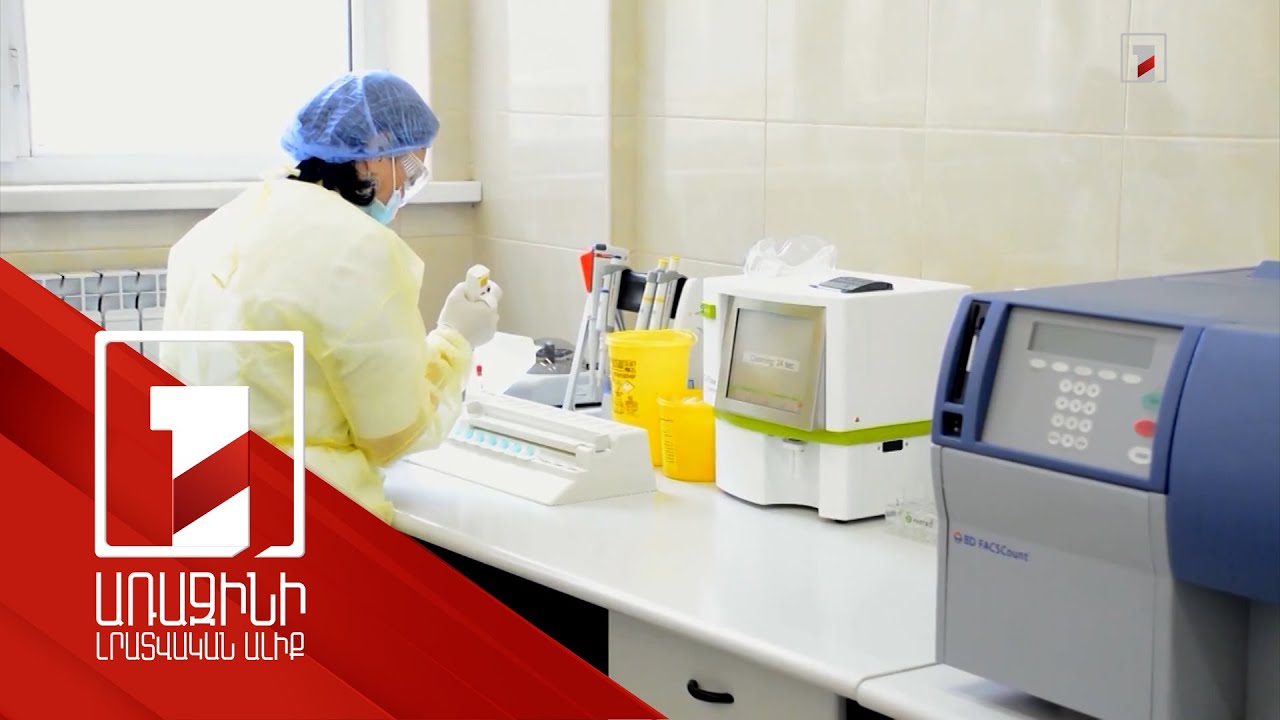Մեկ ամիս ՄԻԱՎ-ի, սիֆիլիսի, հեպատիտ Բ-ի և Ց-ի անվճար հետազոտություններ Երևանում և Աբովյանում