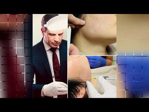 Botox Jaw Slimming with Dr Allen Rezai
