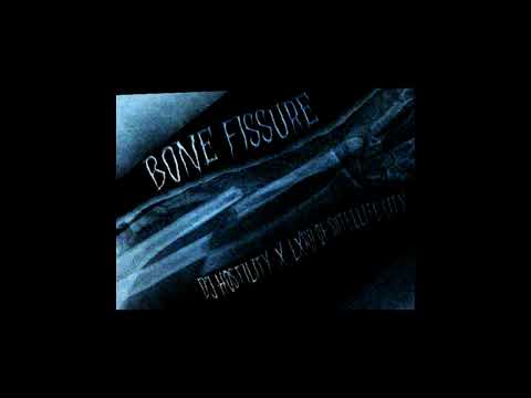 {FREE} Bone Fissure (prod. by LXRD OF SATELLITE CITY x DJ HOSTILITY)