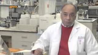 Stupéfiant ! Effet de la curcumine sur les cancers