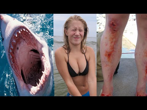 SHE GOT ATTACKED BY A SHARK!?!