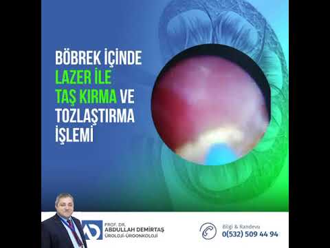 Kısa Video