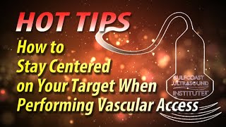 How to Stay Centered on Your Target When Performing Vascular Access