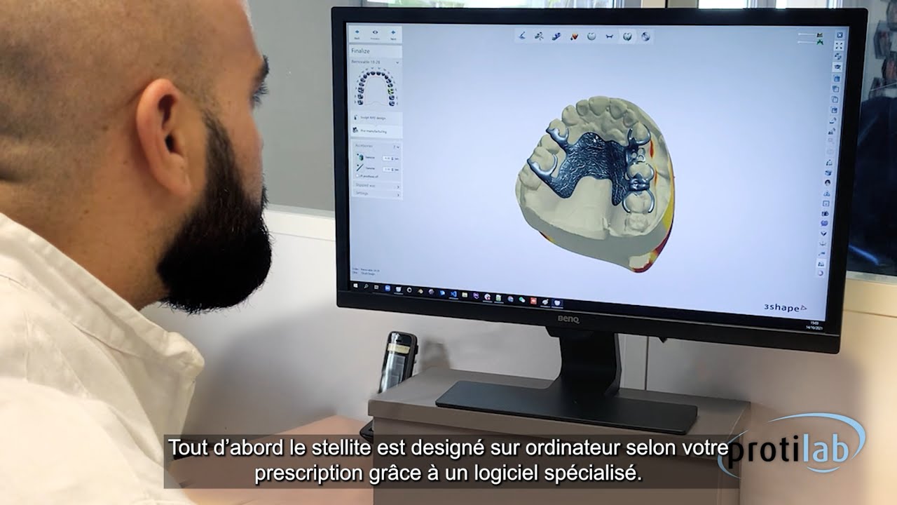 Les Fiches Conseils Protilab : stellite à châssis métallique ou stellite Crystal