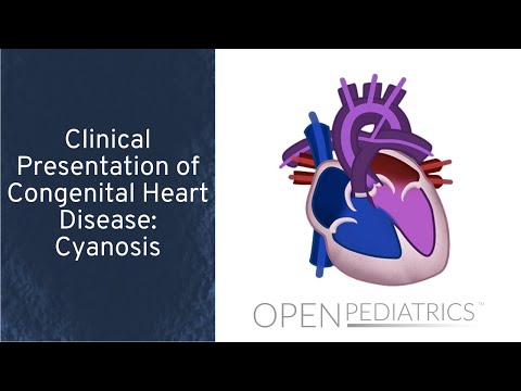 Cyanosis by M. Freed, I. Baiu, L. DelSignore  | OPENPediatrics