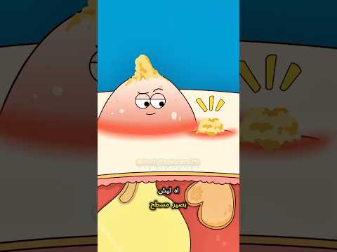 ❗ لا تلمس❗لماذا يجب تجنب عصر البثور؟❓#shorts