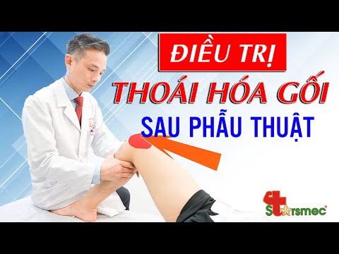 Thoái hóa khớp gối - Kẹt khớp gối sau phẫu thuật - Điều trị như nào?| Bác sĩ Nguyễn Trọng Thuỷ