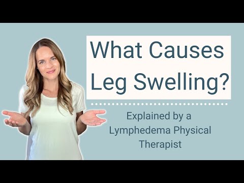 Causes of Leg Swelling, Ankle Edema, and Swollen Feet