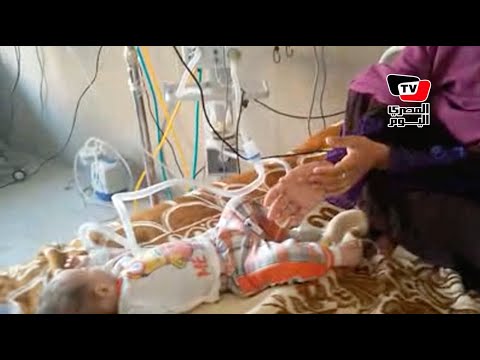 احتجاز أطفال بمستشفى بني سويف لإصابتهم بنزلات معوية حادة