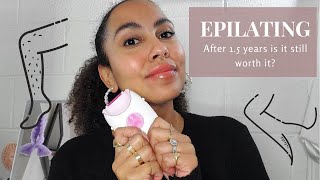 EPILATING AFTER 2 YEARS | IS IT STILL WORTH IT? | HAIR REMOVAL