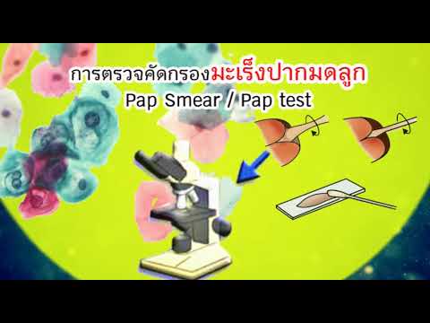 ในขณะที่สมาชิกเก่าเพิ่มขึ้น สูตรของผู้คนเพื่อเพิ่มความแข็งแรง