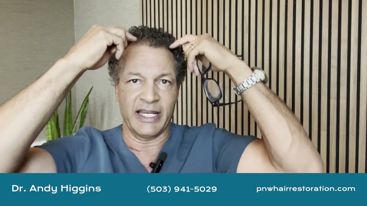 Will my hair transplantation look normal?