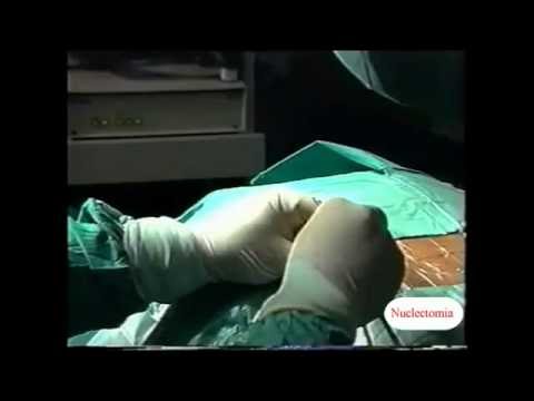 Ob es möglich ist, den Magen für Prostatitis zu wärmen Wie tun Prostata Ultraschall bei Frauen