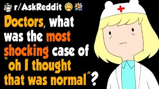 Doctors of Reddit, what is your "oh i thought that was normal?"