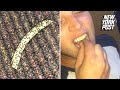 Betting man gags his way through an insect-covered French fry