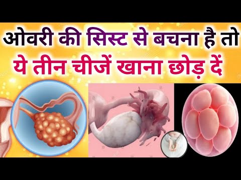 If you want to avoid ovarian cysts, don't eat these 3 things.