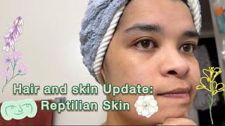 Hair and skin Update: Reptilian Skin | Curly Cami Channel 