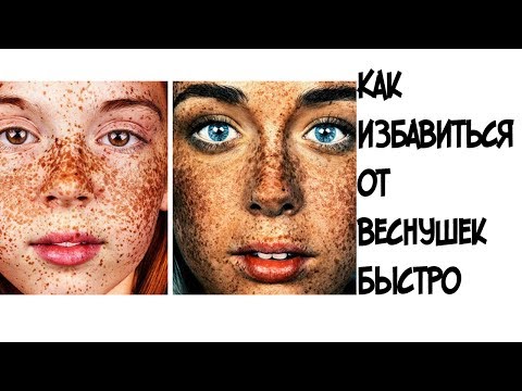 Молоко против веснушек Крем кора от пигментных пятен купить