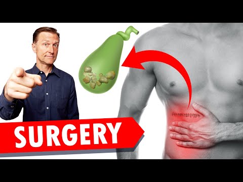 The Top 3 Best Gallbladder Herbs