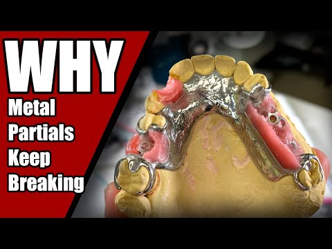 Why Your Partials Keep Breaking & How We Fix Them
