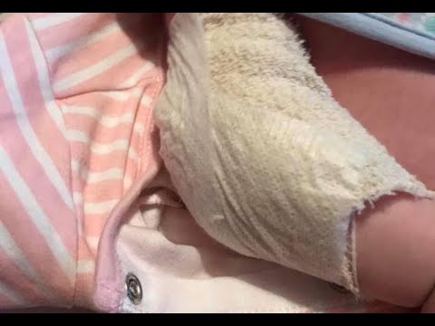 Perché cuore soffre quando si trovano sulla schiena Come camminare con osteoartrite del ginocchio
