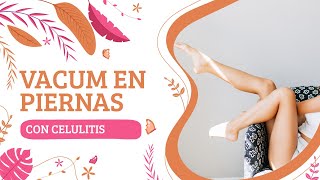 VACUM EN PIERNAS CON CELULITIS dermalia
