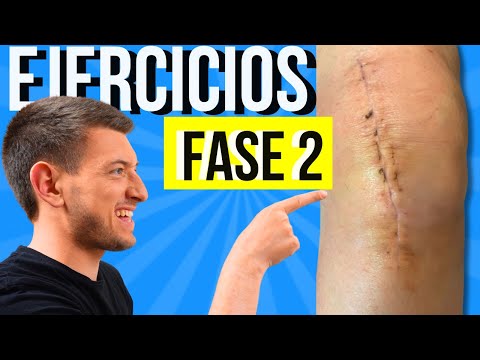 Exercises for Knee Prosthesis or Knee Replacement PHASE 2 (Month 2-3)