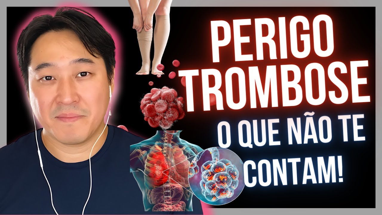 HOW TO PREVENT THROMBOSIS? TIPS TO IMPROVE CIRCULATION.