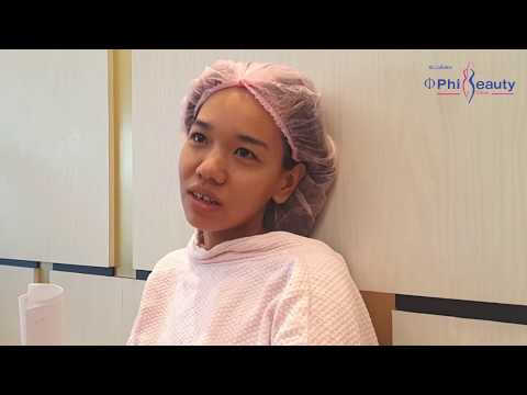 แขน lymphostasis หลังการผ่าตัดเต้านม ขยายเต้านม 1-3