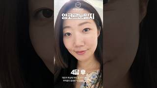 ※눈밑 시술 고민인 분들 이 영상 먼저 보세요※  성형외과전문의가 말합니다. 눈밑에 '이것' 절대 하지마세요!