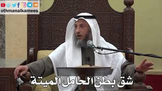 1032 - شق بطن الحامل الميتة - عثمان الخميس - دليل الطالب